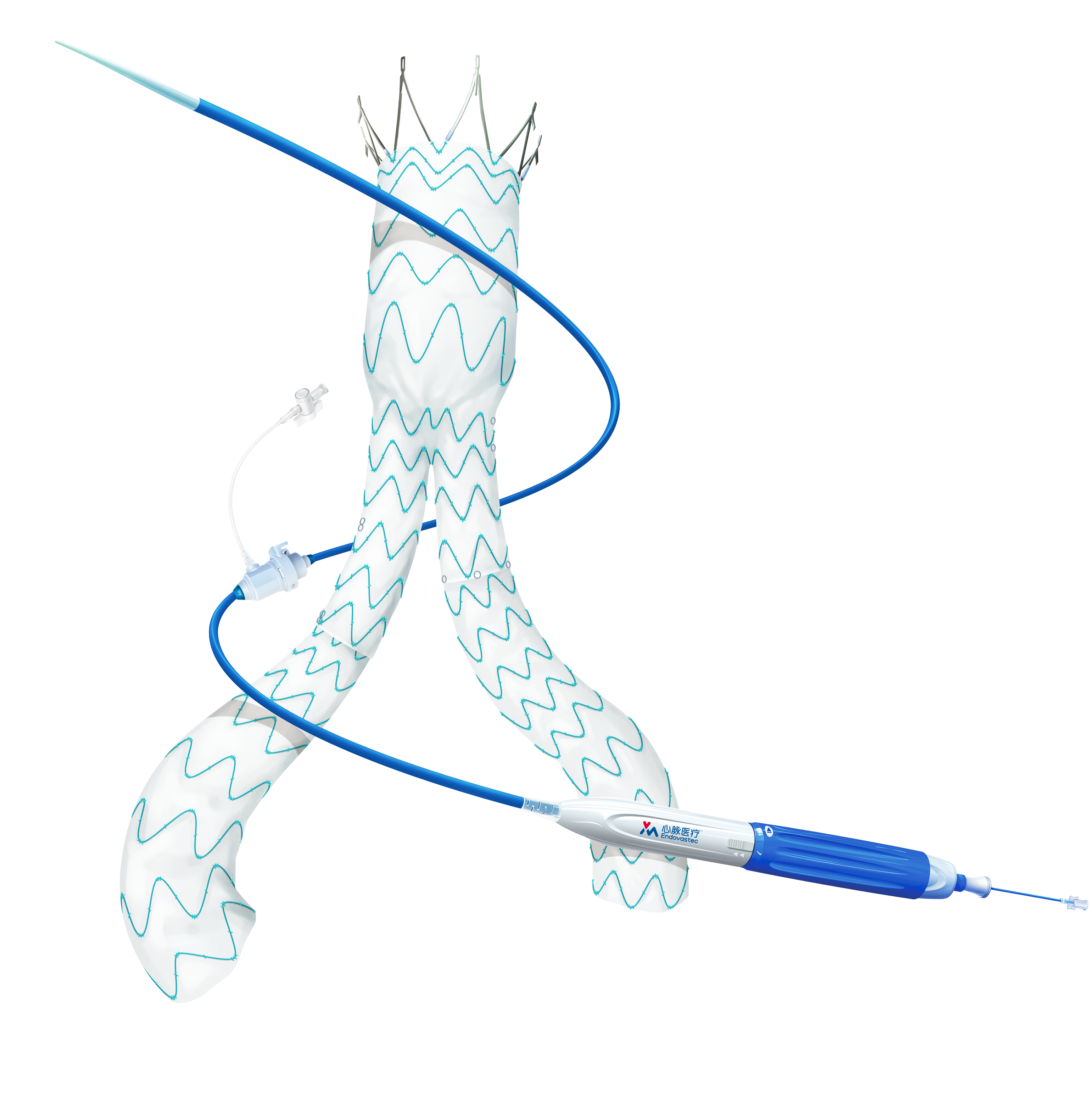 Minos™ Abdominal Aortic Stent Graft and Delivery System